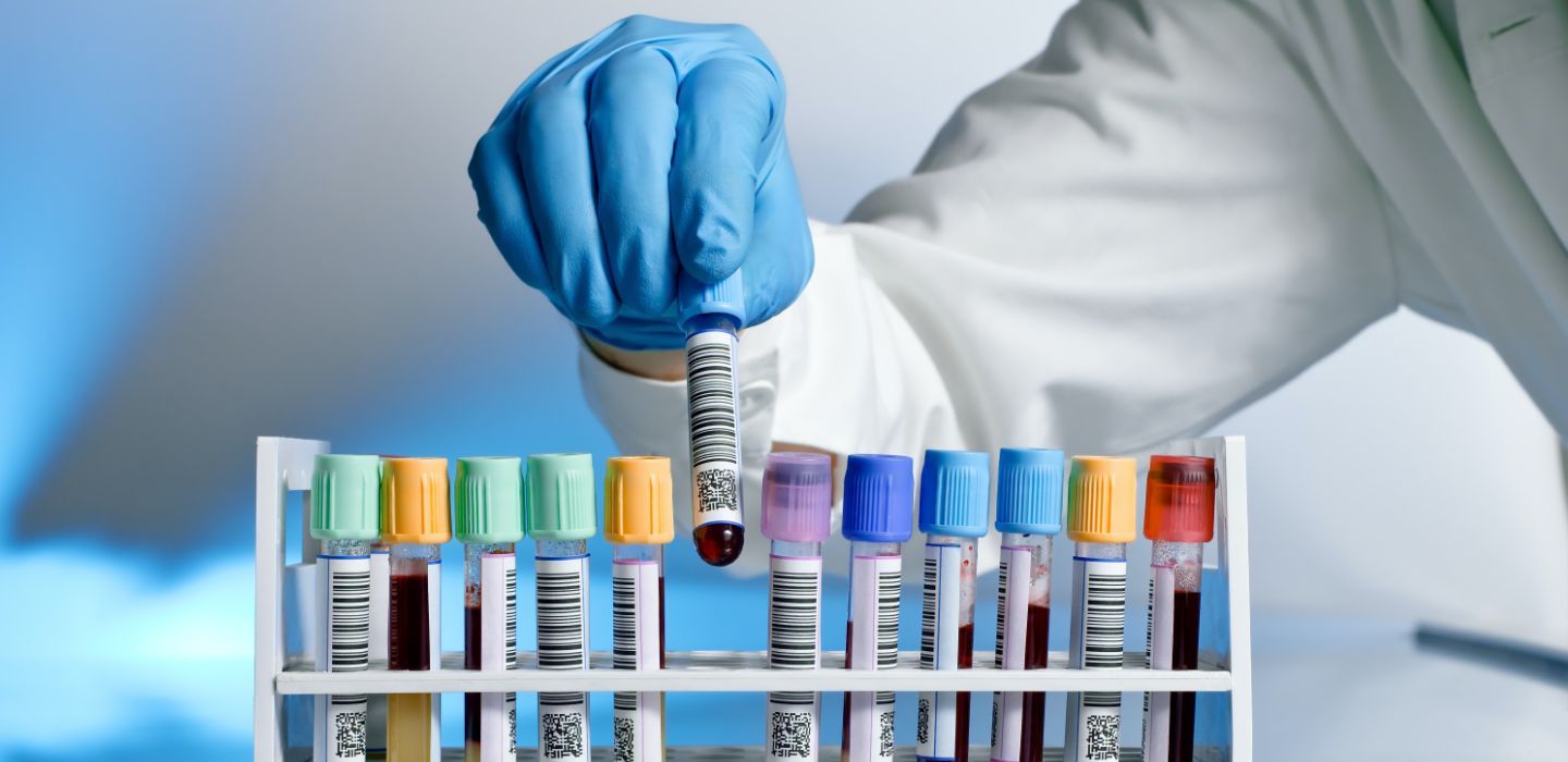 Off campus scientist testing blood tubes